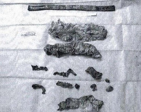 德國粗心醫(yī)生在患者體內(nèi)留下16件異物 家屬提出巨額索賠