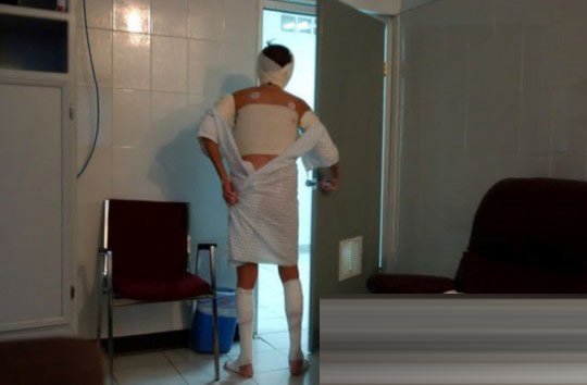 探秘國外令人觸目驚心的廉價(jià)整容