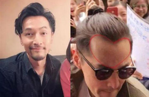 為什么男性禿頭都禿成一個樣？心疼男神們的發(fā)際線
